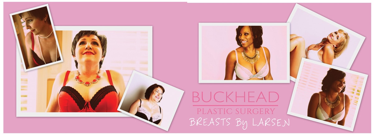 Before and After Photo Gallery | Breast Reconstruction | Buckhead Plastic Surgery | Alan N. Larsen, MD | Board-Certified Plastic Surgeon | Atlanta GA