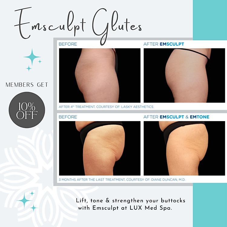 Why Choose LUX Med Spa for Emsculpt?