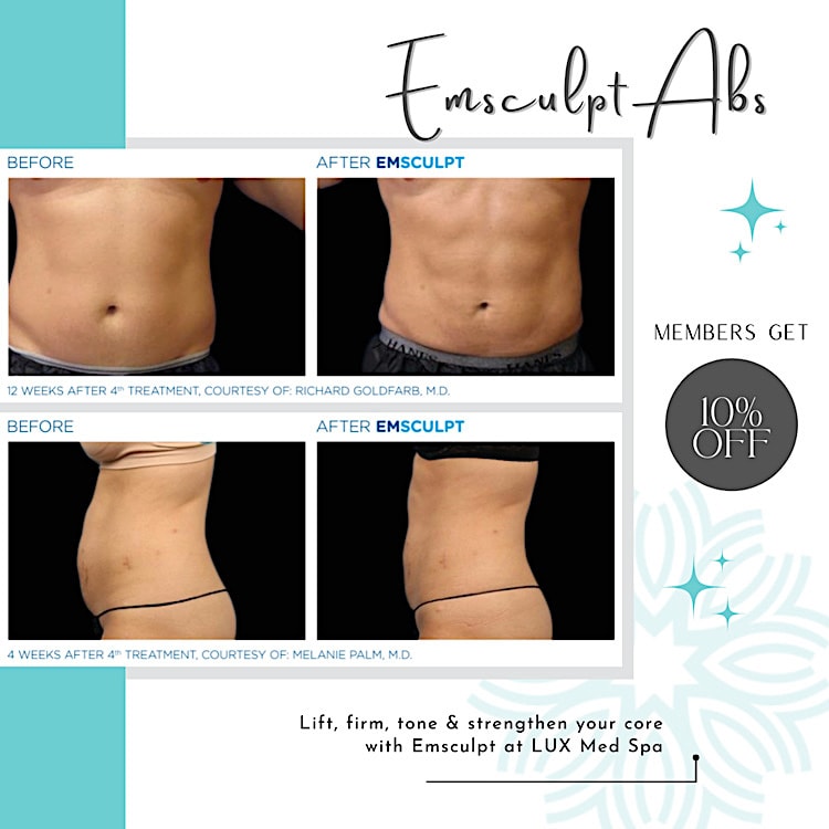 Why Choose LUX Med Spa for Emsculpt?