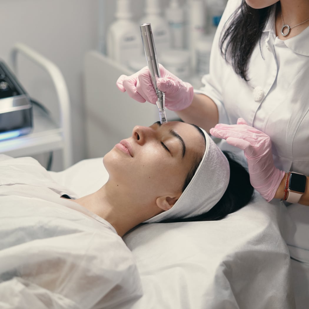 PRP microneedling